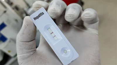 hepatitis