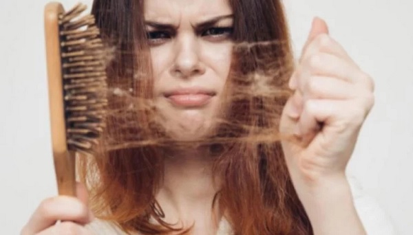 Caída del cabello: lo que se debe saber