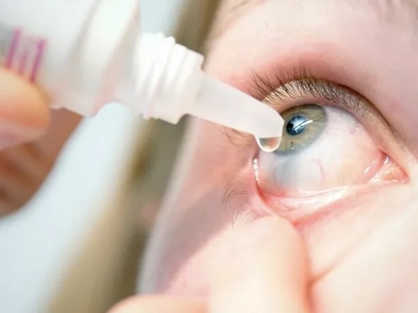 Cuál es el síntoma detectable en los ojos que puede indicar el contagio de Ómicron  La conjuntivitis, que se suma a la calvicie nerviosa y a la diarrea, forman parte de las respuestas extraordinarias que se identificaron en distintos grupos de personas contagiadas. Cuál es el síntoma detectable en los ojos que puede indicar el contagio de Ómicron A diario surgen nuevos estudios sobre el comportamiento de la variante de coronavirus, Ómicron. Ahora, uno de ellos sugiere un posible síntoma que está ligado a los ojos, y que estaría relacionado con una de las maneras en que se contagia. Se trata de una inflamación particular que fue advertida por la médica Nina Aslam, de la Sociedad de Oftalmología Británica del Hospital Real de Londres, y que también apareció en una investigación reciente publicada en la revista científica de la Sociedad Oftalmológica Canadiense. El nuevo posible síntoma de contagio de Ómicron es la conjuntivitis. La oftalmóloga Aslam explicó que es “la inflamación de la conjuntiva, una membrana delgada que recubre el interior de los párpados”. “Los receptores celulares por los cuales las variantes de Covid-19 ingresan al cuerpo están presentes en el ojo. Entonces este virus, ahora mutante, penetra en el cuerpo engañando a los receptores de la enzima convertidora de angiotensina 2 (ACE-2) para que piensen que el virus es la enzima ACE-2″, explicó. A su vez, la médica británica adelantó que los resultados preliminares de la investigación que llevó a cabo demuestran que “estos receptores se encuentran en diferentes partes del ojo: células que recubren la retina, la parte blanca del ojo y el párpado”. Si bien señaló que este síntoma “se ha vuelto más común entre quienes dan positivo de Ómicron”, esto no hará que los pacientes deban quedarse en cama. Esta semana se dio a conocer un informe de la Academia Estadounidense de Dermatología (AAD por sus siglas en inglés), en la que se detectó que la pérdida de cabello podría indicar que la persona se contagió de la nueva cepa del Sars-CoV-2. Asimismo, se identifica por darse en la etapa final de la enfermedad.