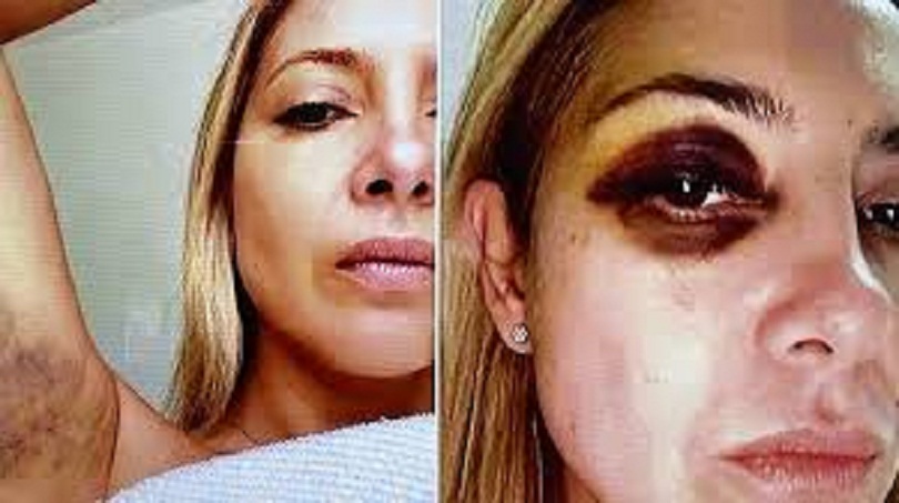  LA ACUSACIÓN DE FABIOLA, LAS FOTOS DE LOS GOLPES Y EL SECUESTRO DEL TELÉFONO: CÓMO SE DESATÓ LA CAUSA POR VIOLENCIA CONTRA ALBERTO FERNÁNDEZ