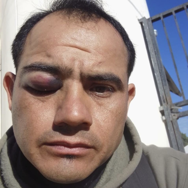 SALVAJE AGRESIÓN A ÁRBITRO EN EL ESTADIO DE BENJAMÍN MATIENZO SACUDE A LA LIGA DE VETERANOS DE FÚTBOL DE GOYA