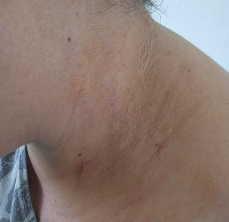 Santa Lucía: Trabajadora municipal agredida por la Concejal LIN MARTÍNEZ