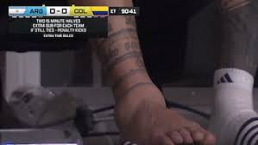INTER MIAMI CONFIRMÓ QUE LIONEL MESSI SUFRIÓ UNA LESIÓN LIGAMENTARIA EN EL TOBILLO DERECHO DURANTE LA FINAL DE LA COPA AMÉRICA