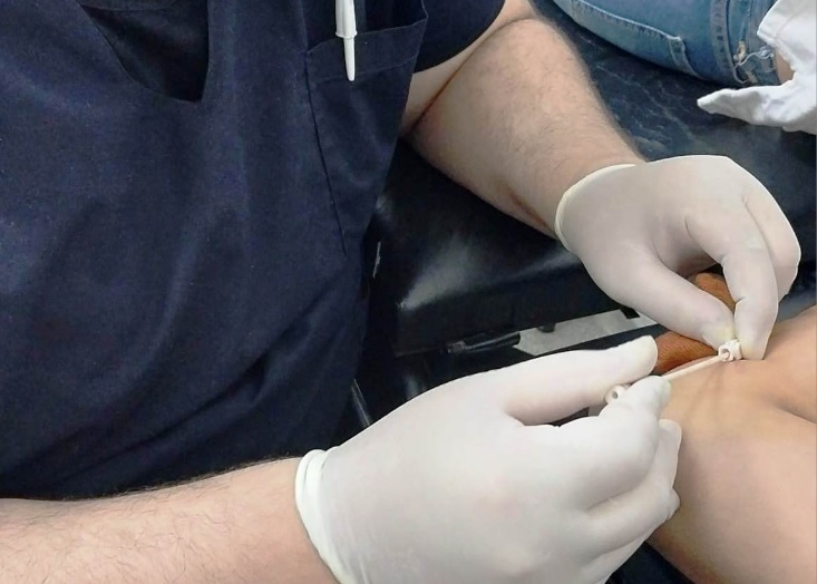 Salud inició la colocación de implantes anticonceptivos de 2 varillas