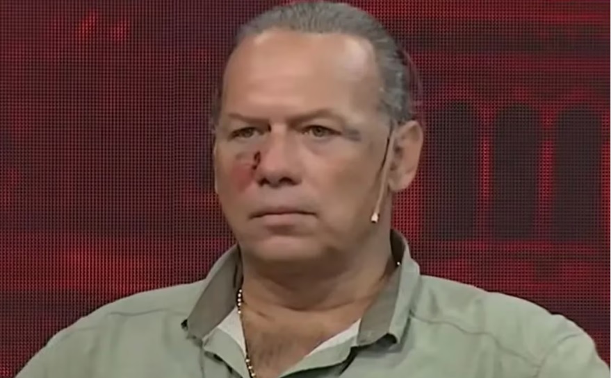 berni agredido